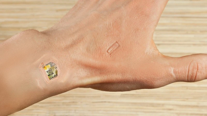 czip podskorny w rece