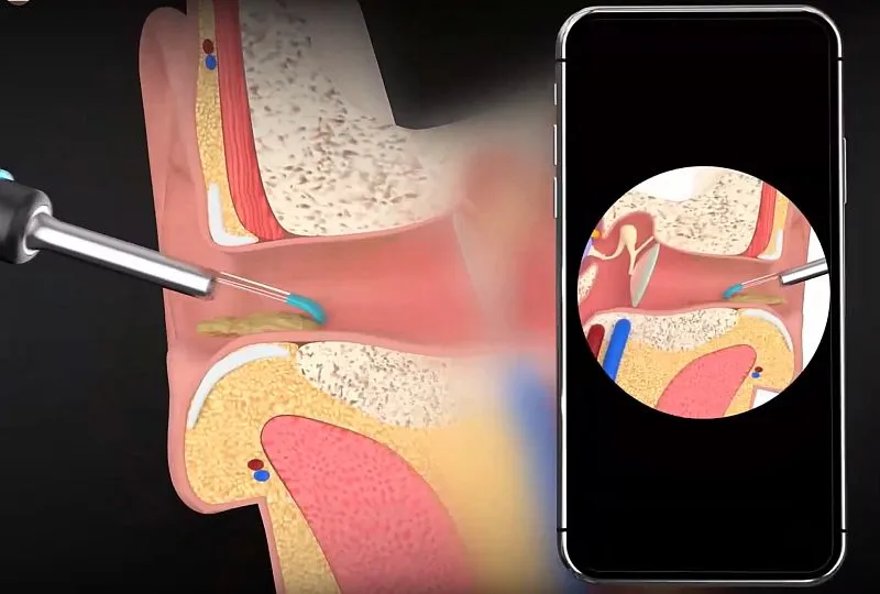 Xiaomi Bebird M9 Pro 2