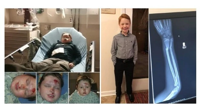 skull breaker challenge