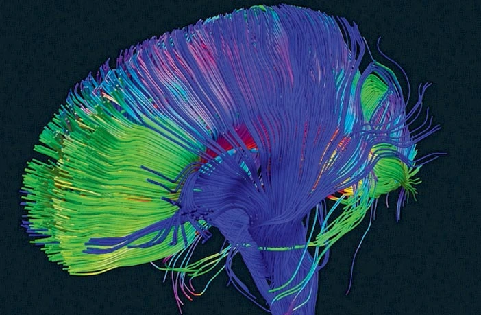 Badania dowodzą, że grający w Starcrafta II posiadają lepiej rozwinięty mózg