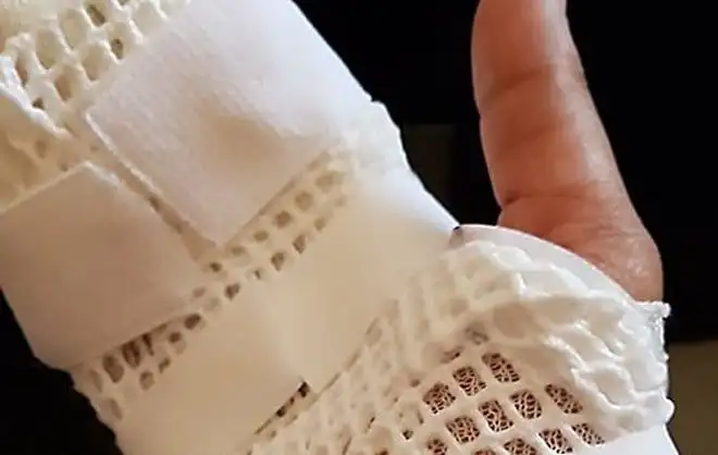 HTC 10 eksplodował w rękach kobiety. Nie był podłączony do ładowarki