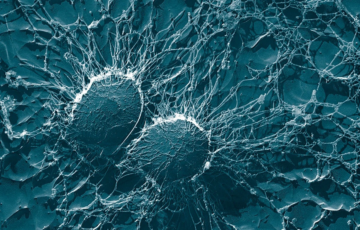 Gronkowiec złocisty