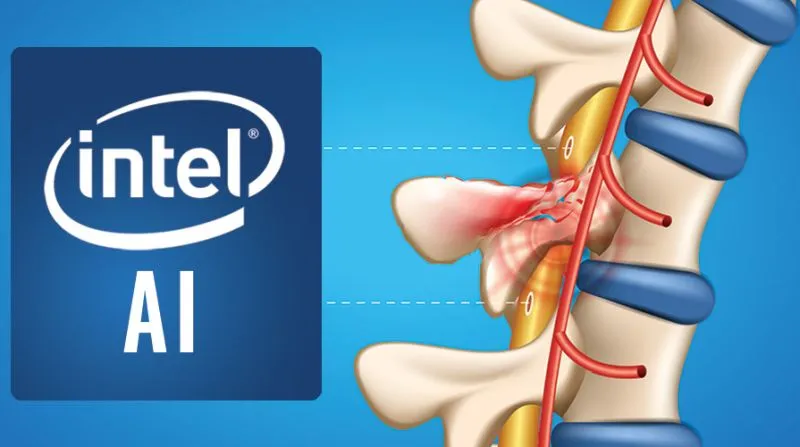 Sztuczna inteligencja Intela będzie pomagać w leczeniu urazów rdzenia kręgowego