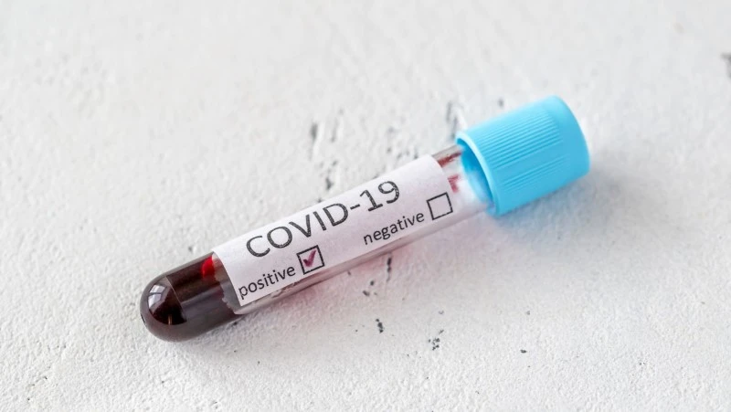 Czy wyzdrowienie z COVID-19 gwarantuje odporność na koronawirusa? Stanowisko WHO