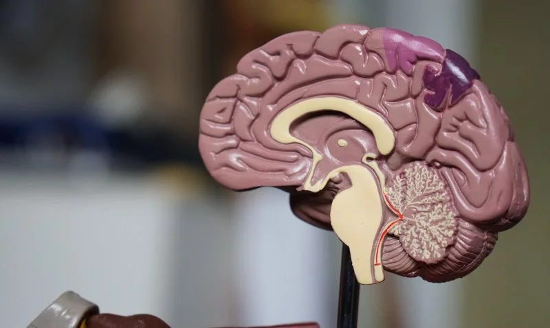 Sztuczna inteligencja Intela będzie wykrywać guzy mózgu