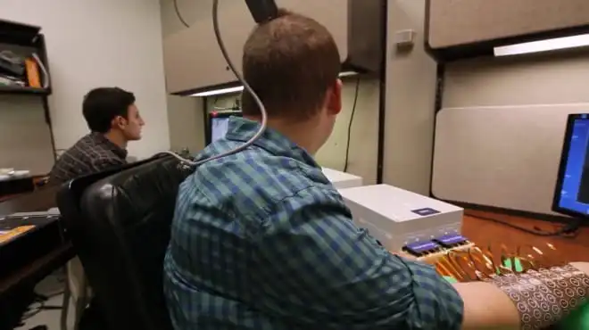 Wszczepiony do głowy chip pozwolił mężczyźnie odzyskać władzę w ręce