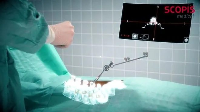 Gogle HoloLens pomogą chirurgom przy operacji