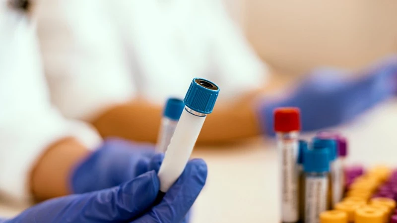 Prywatne testy na koronawirusa już w Polsce. Znamy cenę, są legalne